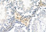 IFI27 Antibody in Immunohistochemistry (Paraffin) (IHC (P))