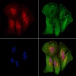 KRT9 Antibody in Immunocytochemistry (ICC/IF)