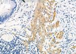 KRT9 Antibody in Immunohistochemistry (Paraffin) (IHC (P))