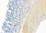 KRT9 Antibody in Immunohistochemistry (Paraffin) (IHC (P))