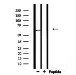 KRT9 Antibody in Western Blot (WB)