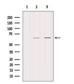 KRT9 Antibody in Western Blot (WB)