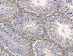 LAMTOR2 Antibody in Immunohistochemistry (Paraffin) (IHC (P))