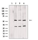 PDCD7 Antibody in Western Blot (WB)