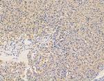 ALPPL2 Antibody in Immunohistochemistry (Paraffin) (IHC (P))