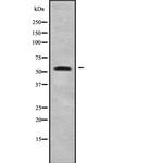 ALPPL2 Antibody in Western Blot (WB)