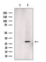 CENPH Antibody in Western Blot (WB)