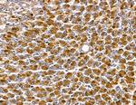 HUS1B Antibody in Immunohistochemistry (Paraffin) (IHC (P))