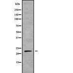 KappaB ras1 Antibody in Western Blot (WB)