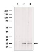 GOLT1B Antibody in Western Blot (WB)