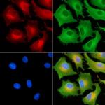 PSMD9 Antibody in Immunocytochemistry (ICC/IF)