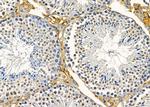 PSMD9 Antibody in Immunohistochemistry (Paraffin) (IHC (P))