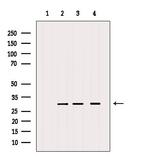 MRPS18B Antibody in Western Blot (WB)