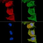 MOGAT3 Antibody in Immunocytochemistry (ICC/IF)