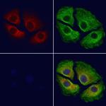 HSD3B1 Antibody in Immunocytochemistry (ICC/IF)