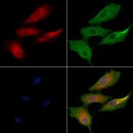 RPL24 Antibody in Immunocytochemistry (ICC/IF)