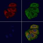 RPL24 Antibody in Immunocytochemistry (ICC/IF)