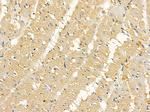 RPL7A Antibody in Immunohistochemistry (Paraffin) (IHC (P))