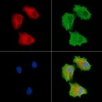 INPP5E Antibody in Immunocytochemistry (ICC/IF)