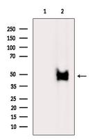 ABHD1 Antibody in Western Blot (WB)