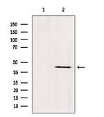 ABHD13 Antibody in Western Blot (WB)