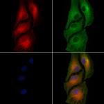 ABLIM1 Antibody in Immunocytochemistry (ICC/IF)