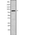 ABLIM1 Antibody in Western Blot (WB)