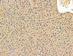 ACAD9 Antibody in Immunohistochemistry (Paraffin) (IHC (P))