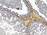 AWAT2 Antibody in Immunohistochemistry (Paraffin) (IHC (P))