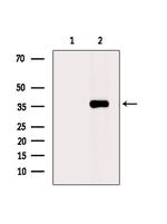 AWAT2 Antibody in Western Blot (WB)