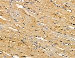 LPGAT1 Antibody in Immunohistochemistry (Paraffin) (IHC (P))