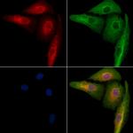 ACBD5 Antibody in Immunocytochemistry (ICC/IF)