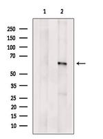 ACBD5 Antibody in Western Blot (WB)