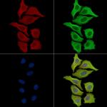 ACOT9 Antibody in Immunocytochemistry (ICC/IF)