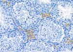 AOAH Antibody in Immunohistochemistry (Paraffin) (IHC (P))