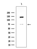 ADAM23 Antibody in Western Blot (WB)