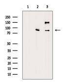 ADAM28 Antibody in Western Blot (WB)