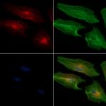 ADAM33 Antibody in Immunocytochemistry (ICC/IF)