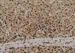 ADAM33 Antibody in Immunohistochemistry (Paraffin) (IHC (P))