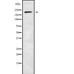 ADAMTS20 Antibody in Western Blot (WB)