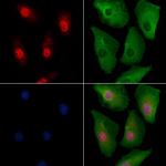 RPP25L Antibody in Immunocytochemistry (ICC/IF)