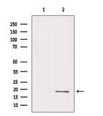 RPP25L Antibody in Western Blot (WB)