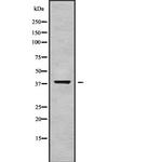 GALM Antibody in Western Blot (WB)