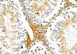 ASAH3 Antibody in Immunohistochemistry (Paraffin) (IHC (P))