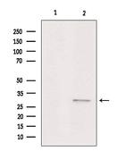 ASAH3 Antibody in Western Blot (WB)