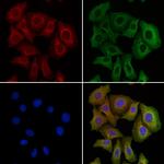 AAMP Antibody in Immunocytochemistry (ICC/IF)