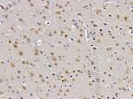 A2BP1 Antibody in Immunohistochemistry (Paraffin) (IHC (P))