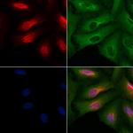 ATXN7L3 Antibody in Immunocytochemistry (ICC/IF)