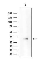 ATXN7L3 Antibody in Western Blot (WB)