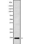 ATP5G1 Antibody in Western Blot (WB)